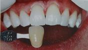 Kor-whitening-After-Image